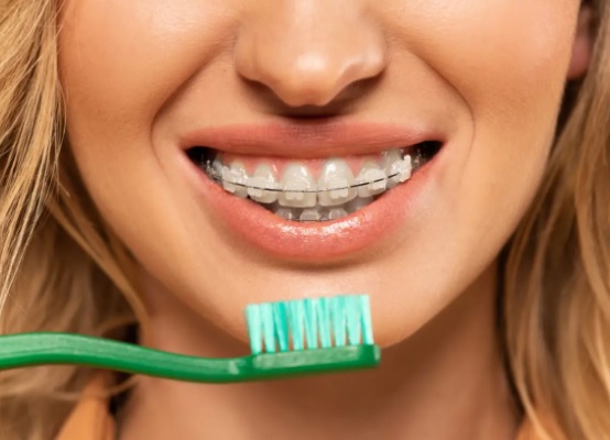Jakie są najlepsze praktyki higieny jamy ustnej podczas noszenia aparatu ortodontycznego?