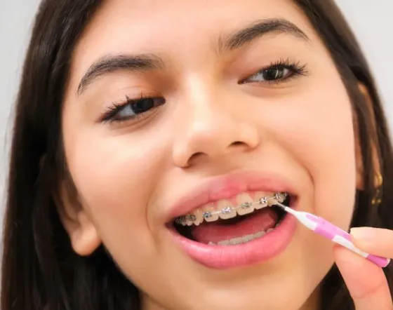 Jakie są rekomendowane techniki szczotkowania zębów dla osób noszących aparaty?​