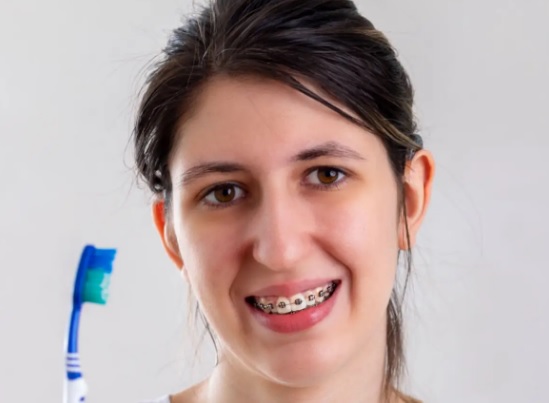 Czy stosowanie nici dentystycznych jest konieczne przy noszeniu aparatu ortodontycznego?