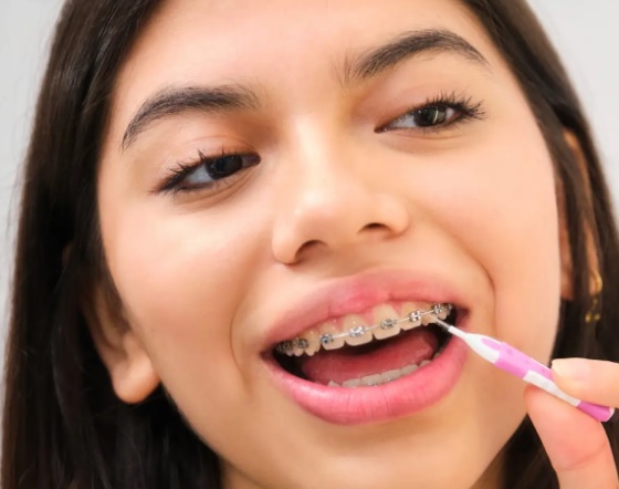 Jak radzić sobie z podrażnieniami i ranami w jamie ustnej spowodowanymi aparatem?