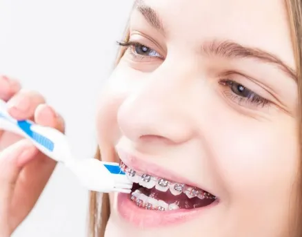 Czy profesjonalne czyszczenie u dentysty jest konieczne podczas leczenia ortodontycznego?